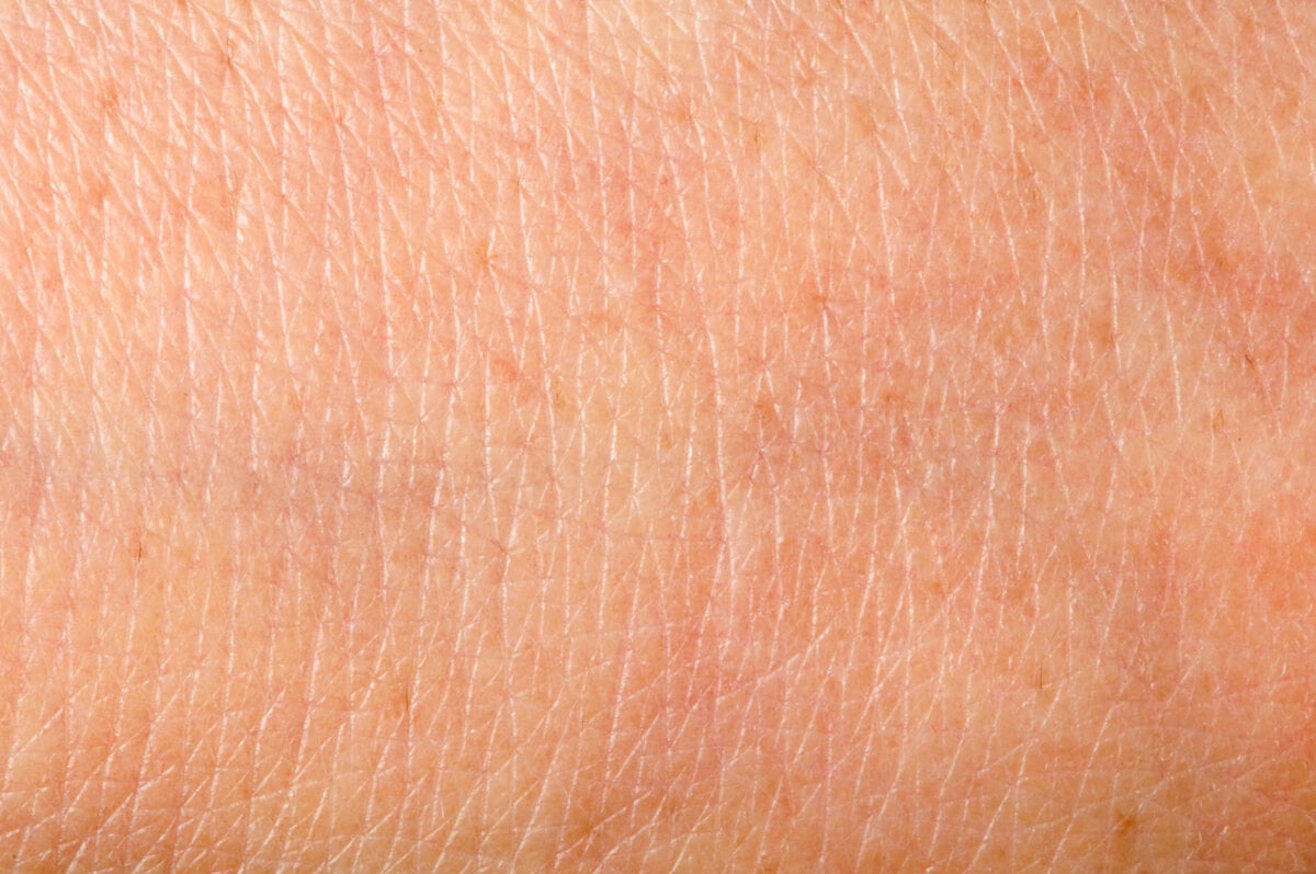 PielSeca_Cosmeticos24h_48035020